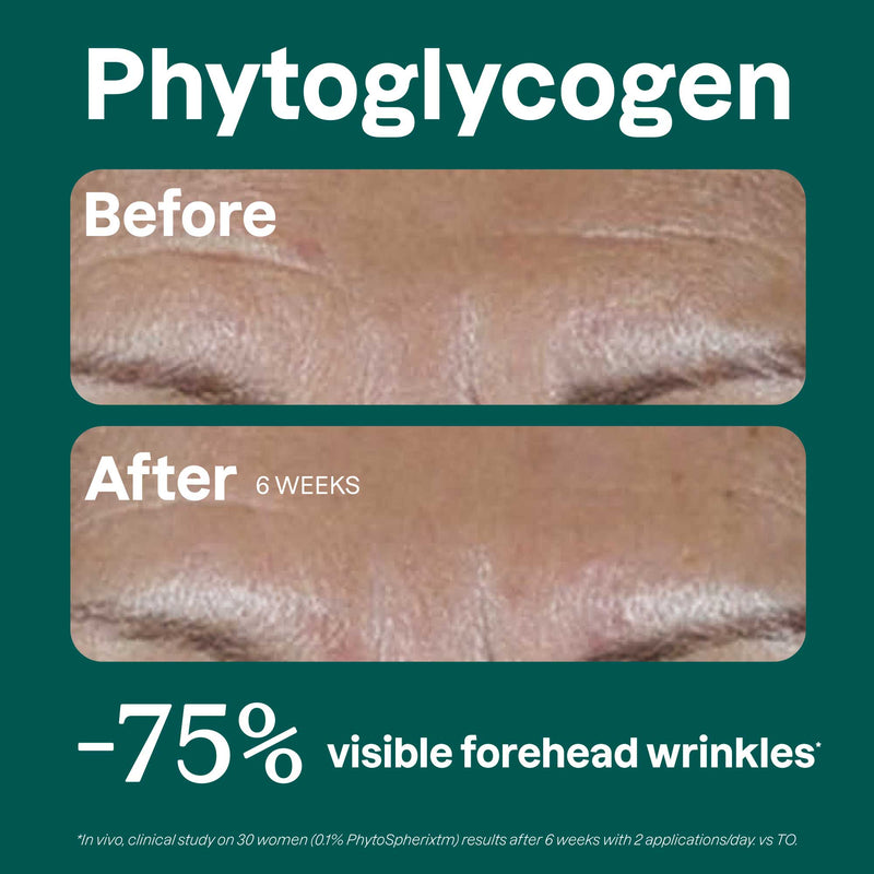 ATTITUDE Solid Matifying Face Cream for Combination Skin with Phytoglycogen-Before-after_en? ALL_VARIANTS